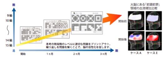 セレンブレインは一人ひとりの思考段階に最適な問題をプリントアウトし、脳の活性化を促す。